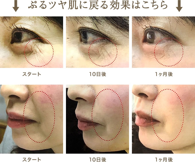 ぷるツヤ肌に戻る効果はこちら